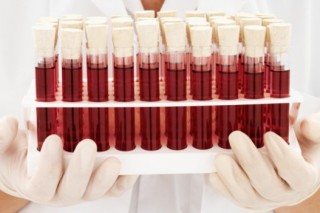 Ученые заявляют: скоро будет создана искусственная кровь