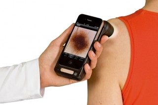 Рак кожи можно будет диагностировать при помощи iPhone