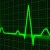 Разработан новый кардиостимулятор, учитывающий ритм дыхания